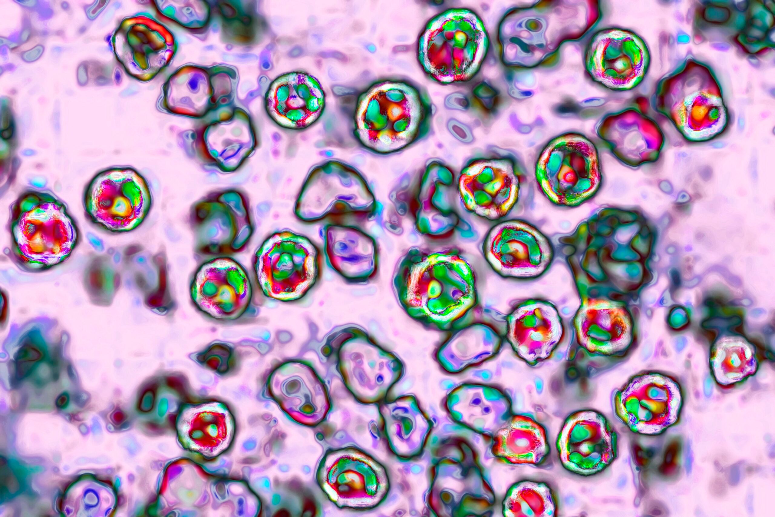 Measles Cases Have Just Been Confirmed in 4 More States